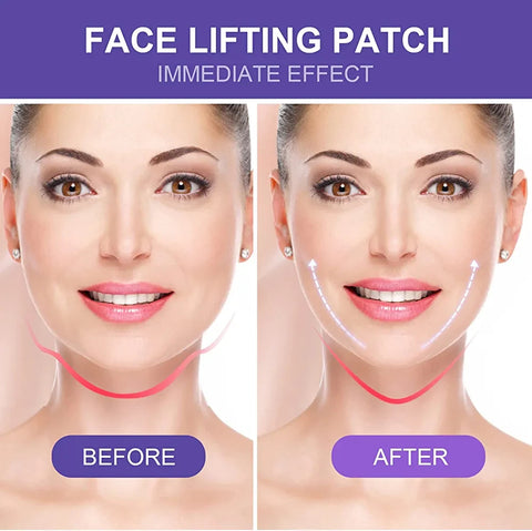 Image of Parches de levantamiento facial